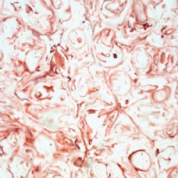 Translucent stone panel